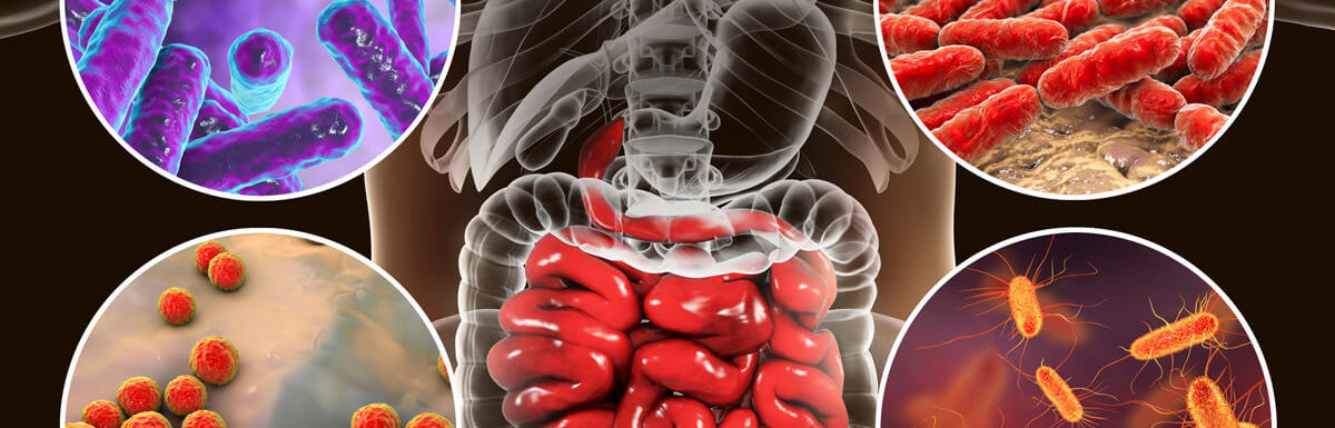 Lyme disease and digestive issues