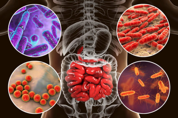 Fresh Look at Gastrointestinal Symptoms Of Lyme Disease